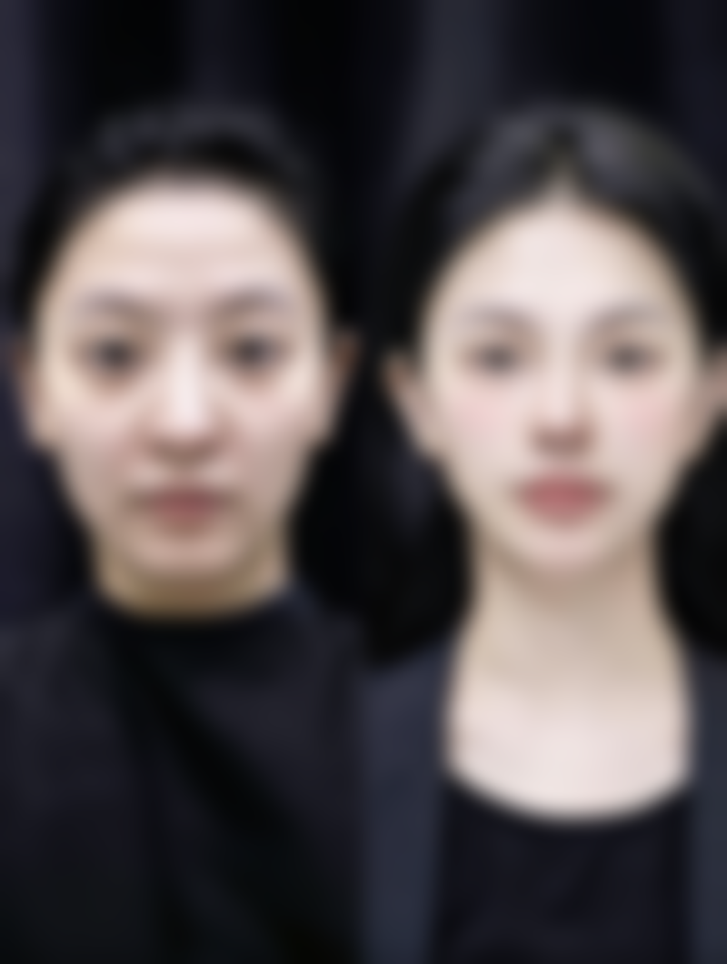 承德名媛整形医院口碑评价怎么样？