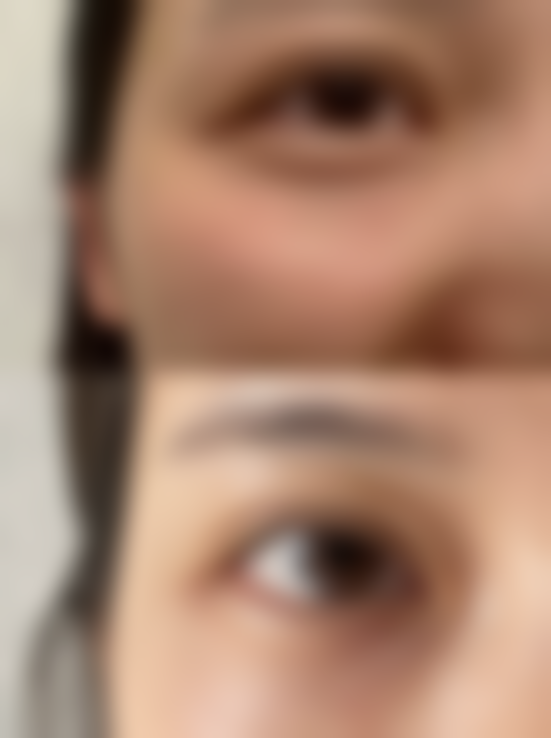 佛山瑞致整形医院怎么预约