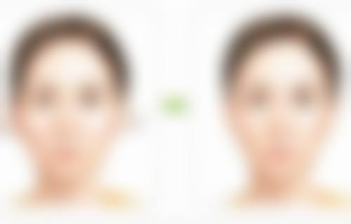 深圳王狮传奇医疗美容门诊部正规吗？