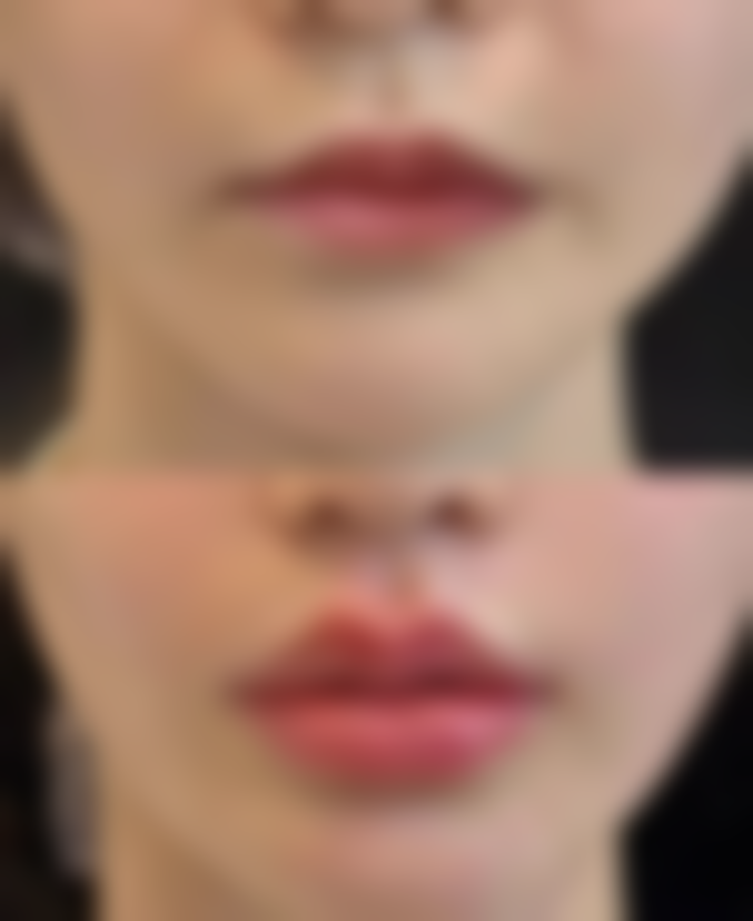 厦门三维焕新整形医院正规吗？