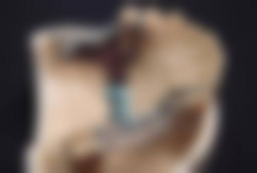 莆田维纳斯整形医院口碑评价怎么样？