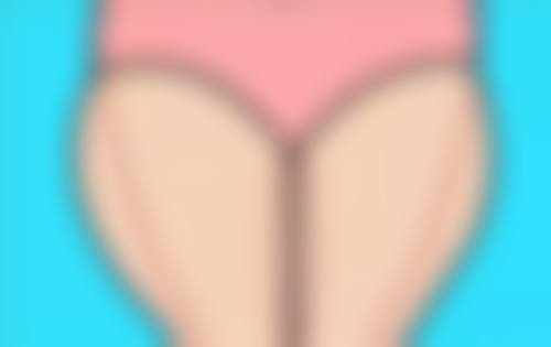 深圳汇瑷美医疗美容门诊部口碑评价怎么样？