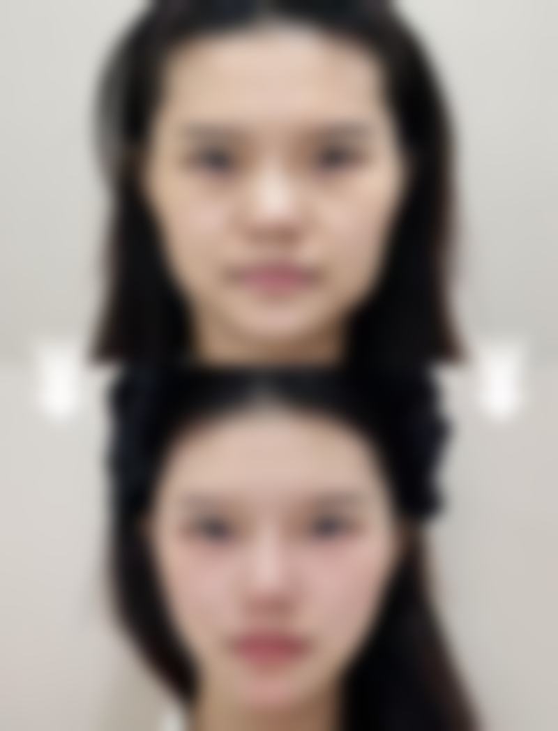 石家庄王历整形医疗美容正规吗？