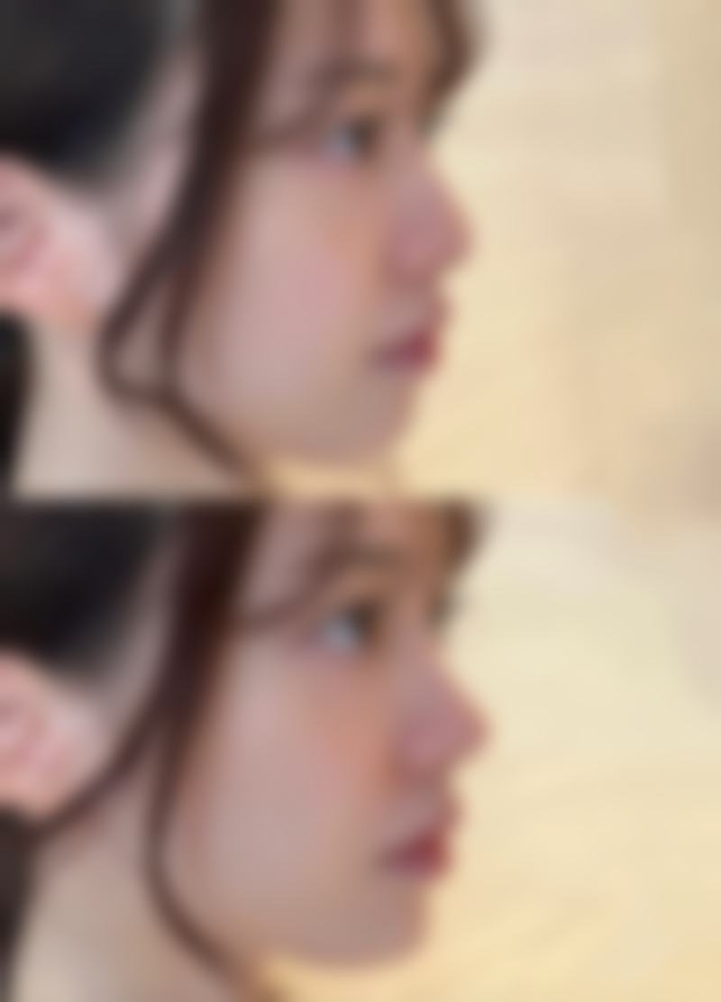 保定蓝途整形医院怎么预约：