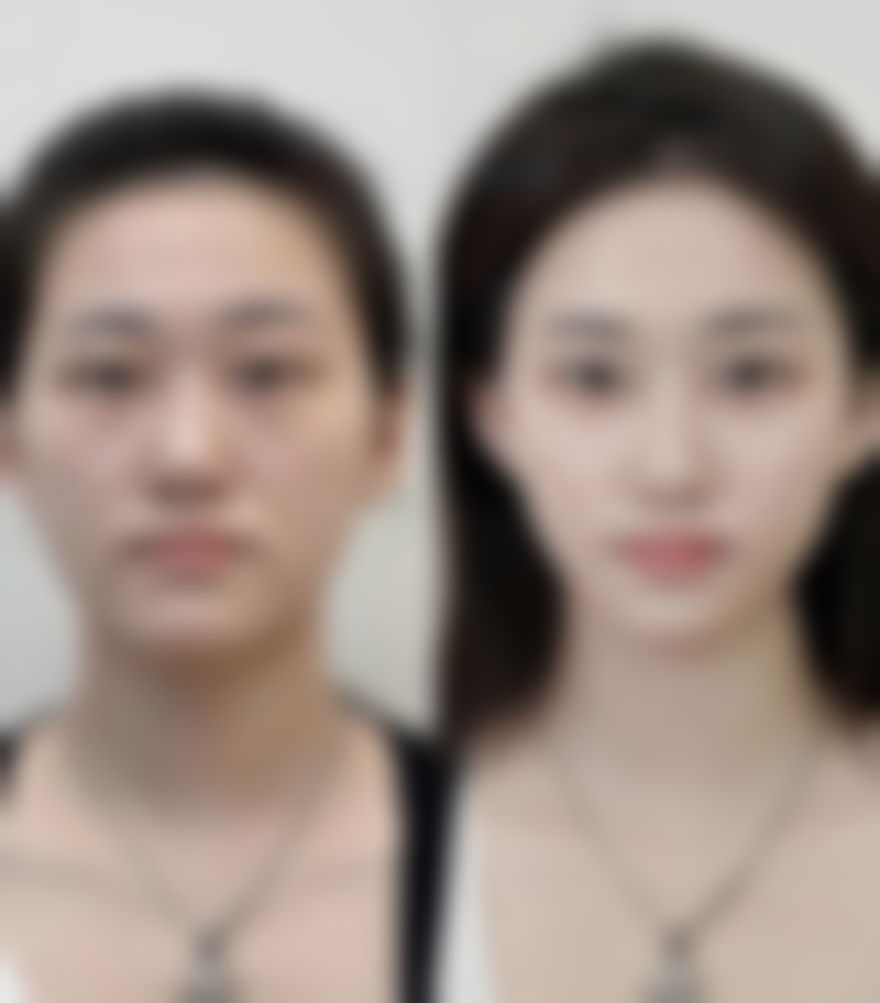 郴州青源医疗美容医院刘尚海医生中胚美塑疗法技术怎么样？