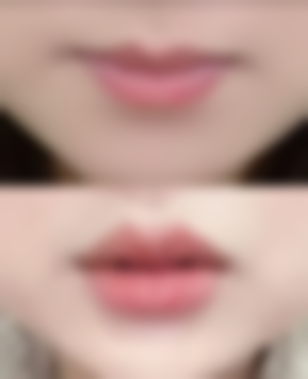 郴州青源医疗美容医院刘尚海医生收费价格：