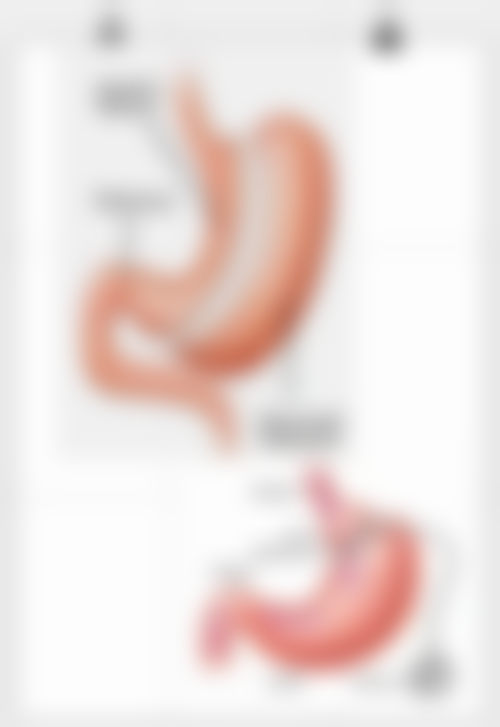 韩国首尔slim整形医院