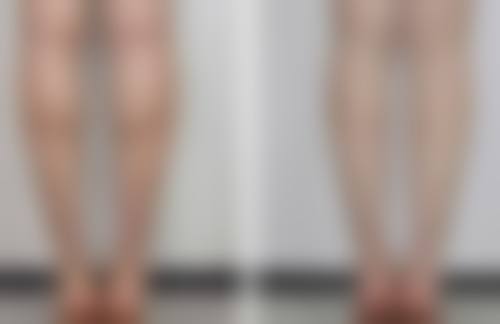 无锡大麦医疗美容诊所刘汉敏医生收费价格