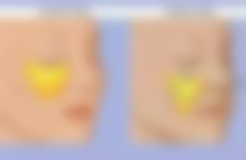 杭州章小蝶医疗美容诊所基本信息