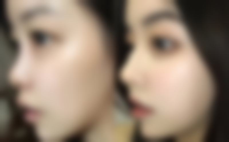 成都美斯迪医疗美容诊所蒋浪医生患者评价