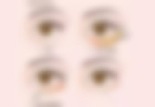 韩国高恩世上整形外科医院口碑评价怎么样？