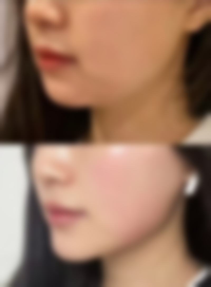 武汉斯启诺医疗美容门诊部叶锋擅长的面部轮廓整形项目