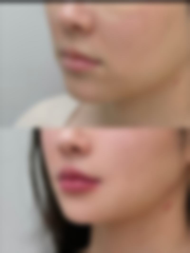 青岛半岛丽人医学美容诊所正规吗？