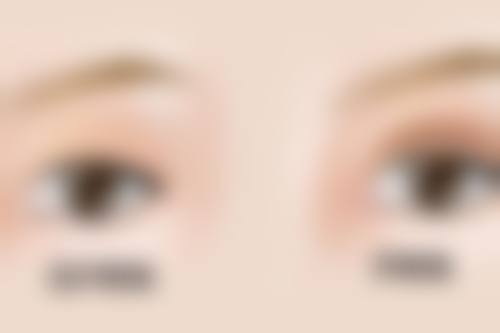 河南科技大学第二附属医院整形美容外科怎么预约：