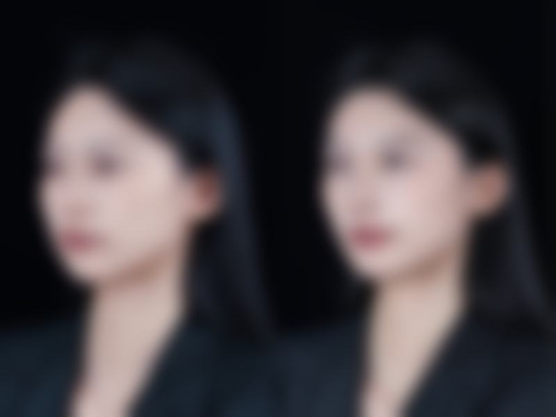 徐州新生植发正规吗？