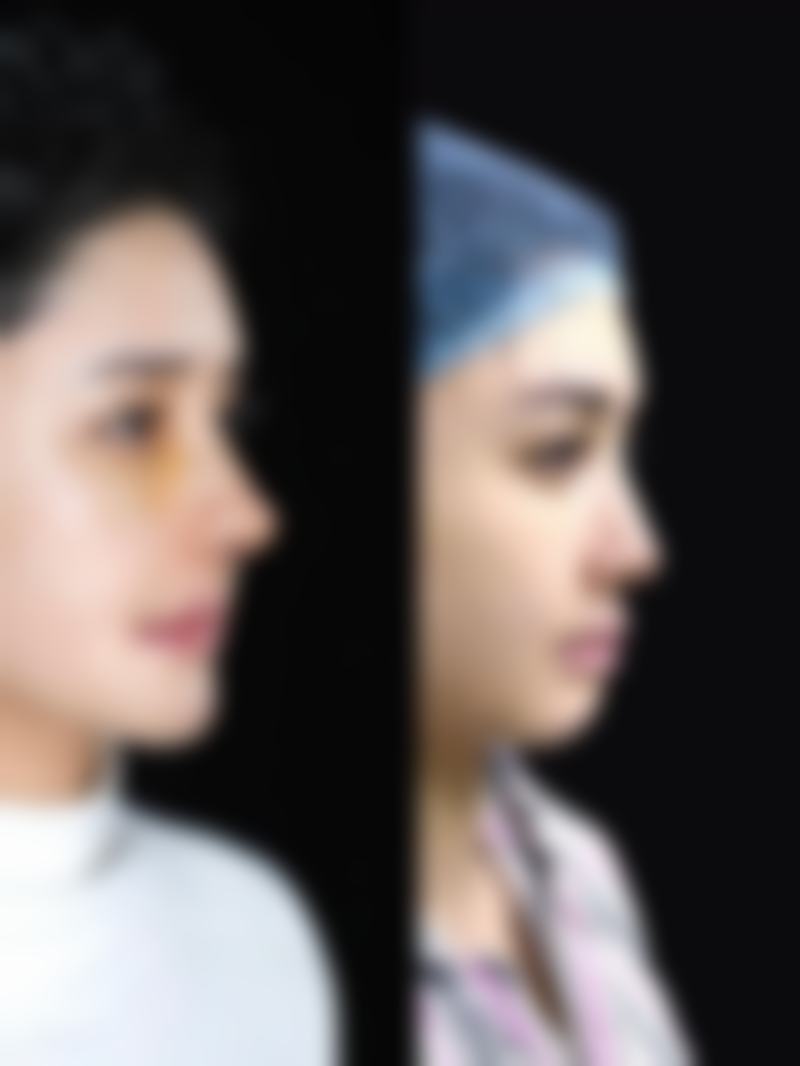 泰州丽臻整形医院怎么预约