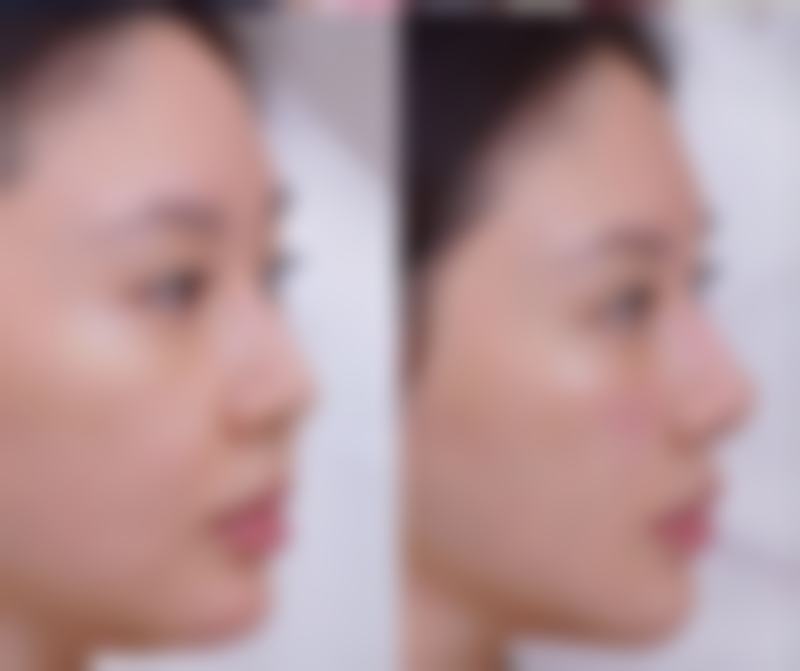 韩国赖布利LIVELY整形外科医院正规吗？