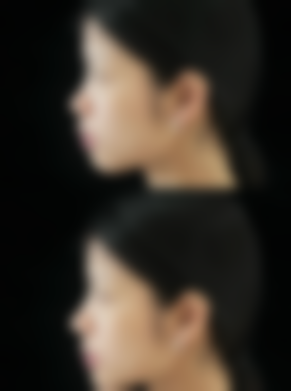 河南科技大学第二附属医院整形美容外科口碑评价怎么样？