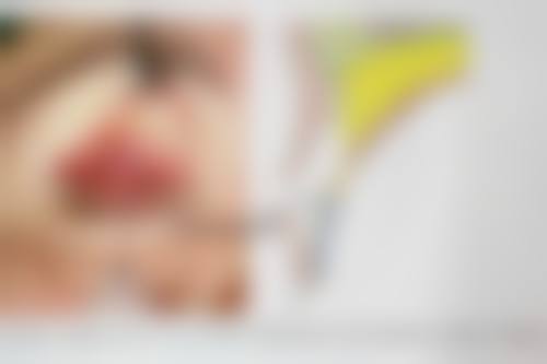 朝阳京城皮肤医院整形科沈文誉医生自体脂肪隆鼻技术怎么样？