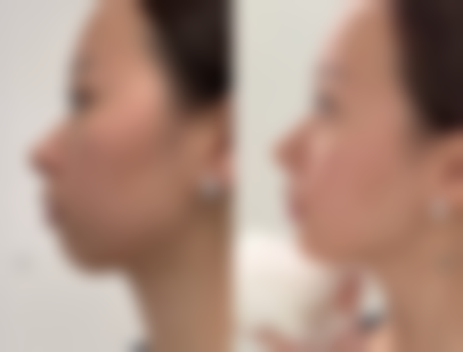 朝阳京城皮肤医院整形科沈文誉医生患者评价