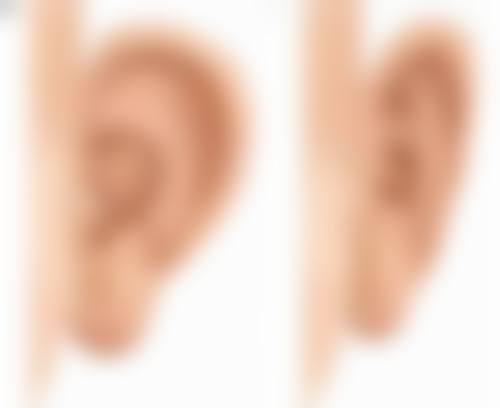 韩国GOOD FILLER整形外科医院口碑评价怎么样？