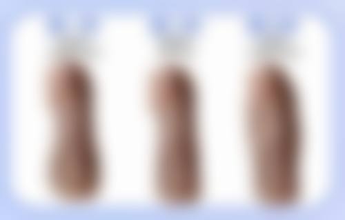 武汉斯启诺医疗美容门诊部董雷医生的优质服务态度