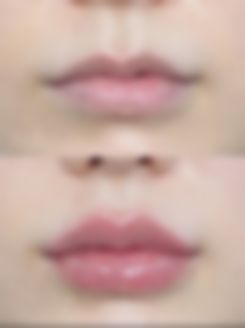 韩国GOOD FILLER整形外科医院基本信息