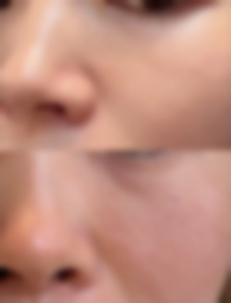 徐州美玲医疗美容怎么预约