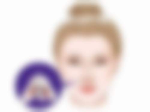 深圳大学总医院整形美容科张双耀医生双眼皮技术怎么样？