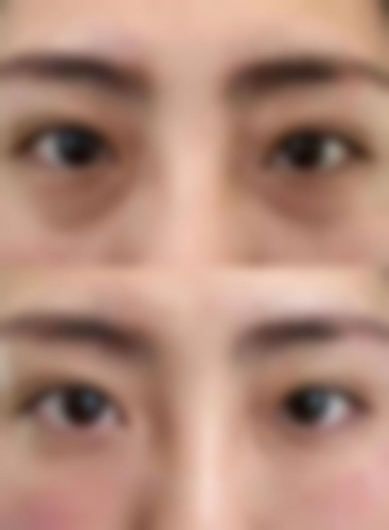 重庆鑫瑞整形医院口碑评价怎么样？