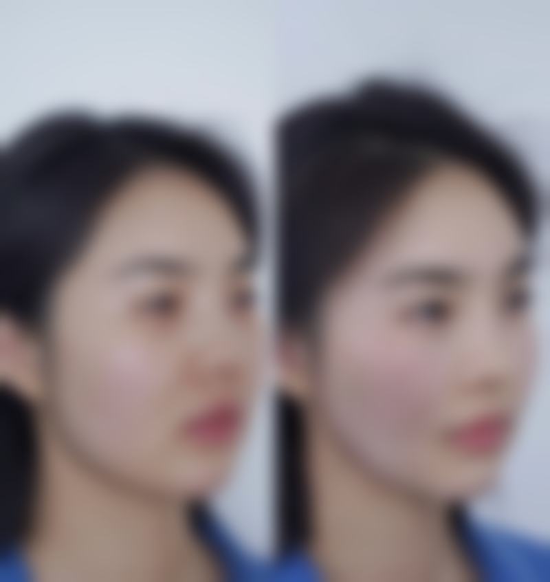 江门侨都华美整形美容医院怎么预约