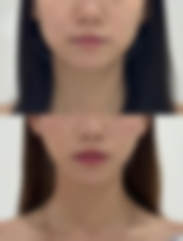 南宁伊莱美医疗美容门诊部正规吗？