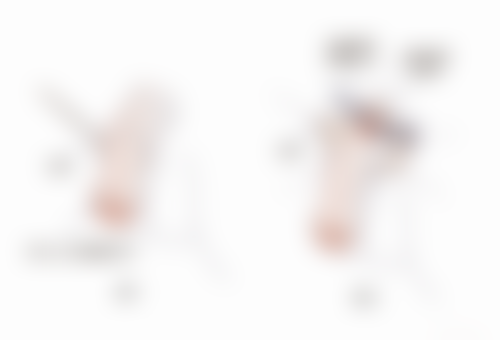 太原晋绮医疗美容诊所詹本立医生患者评价