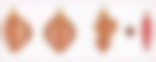 重庆医科大学附属第一医院（医疗美容科）正规吗？