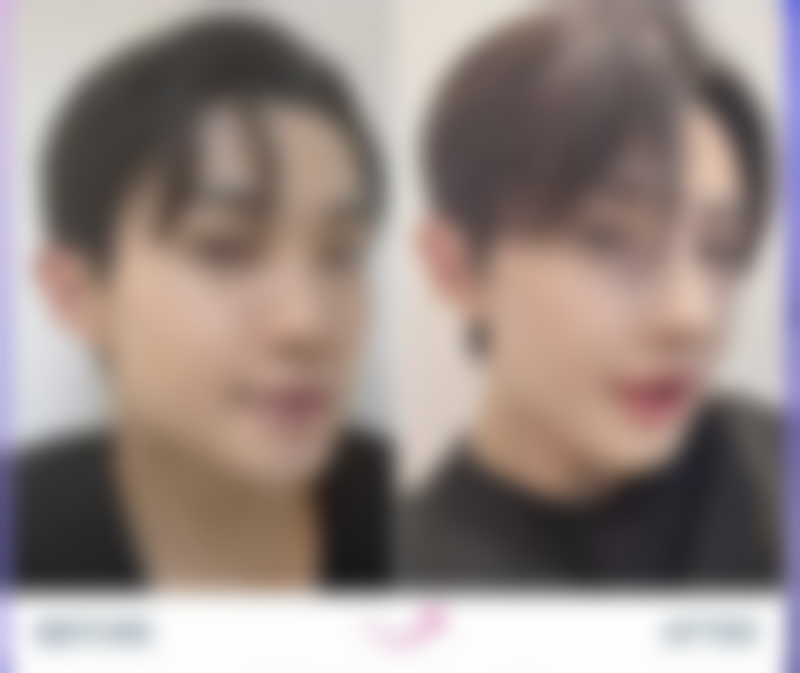 韩国well整形医院怎么预约