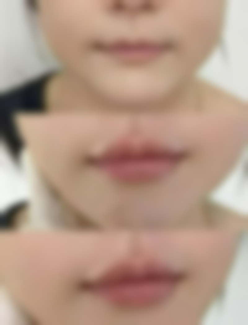 深圳美态美肤医疗美容诊所朴相勋医生颅颌面整形技术怎么样？