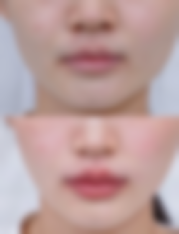 韩国江南富蒂整形医院正规吗？