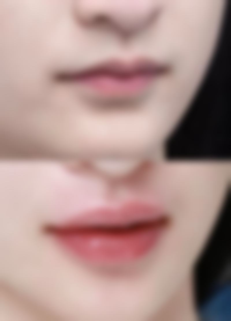 深圳美态美肤医疗美容诊所朴相勋医生擅长项目