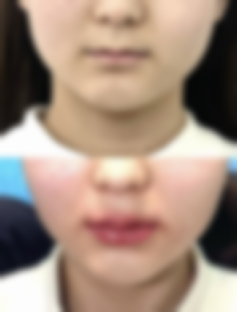 太原晋绮医疗美容诊所詹本立医生预约挂号指南