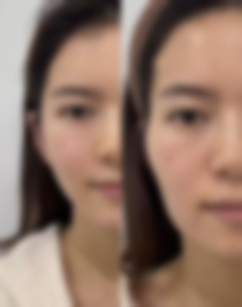 深圳美态美肤医疗美容诊所朴相勋医生患者评价