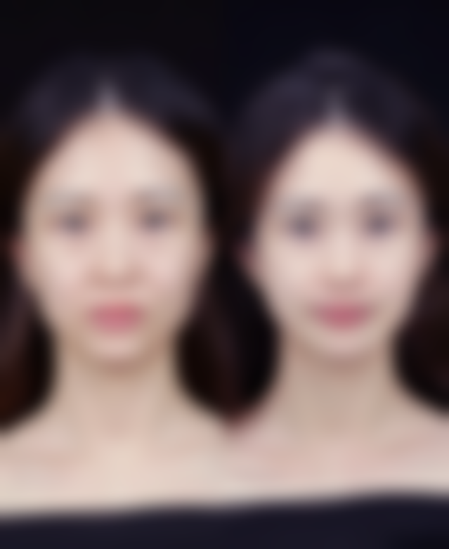 南通幻美整形医院收费价格表