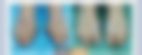 吉林市侯氏整形医院怎么预约