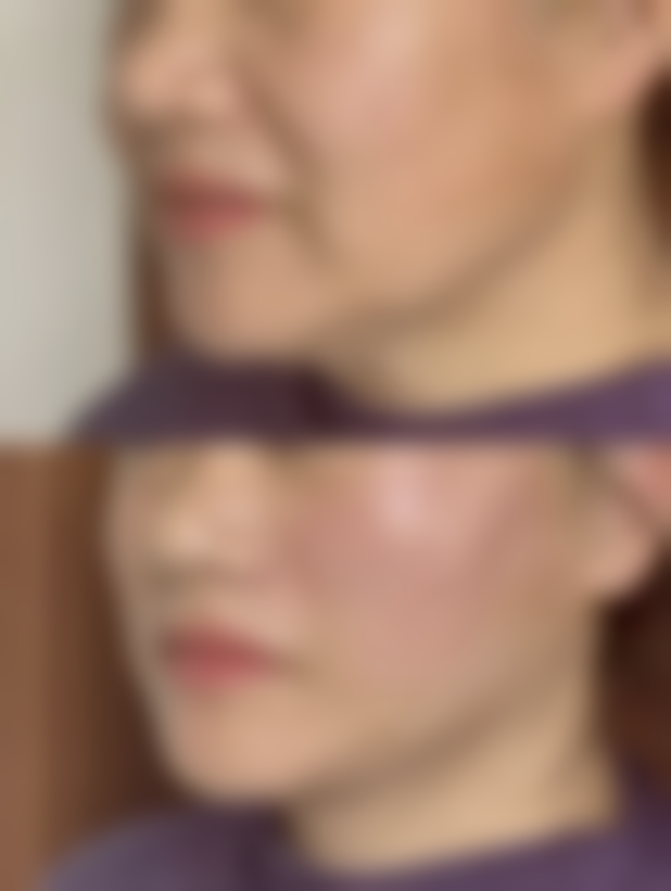 河南大学附属南石医院烧伤整形美容中 心徐文举医生擅长项目