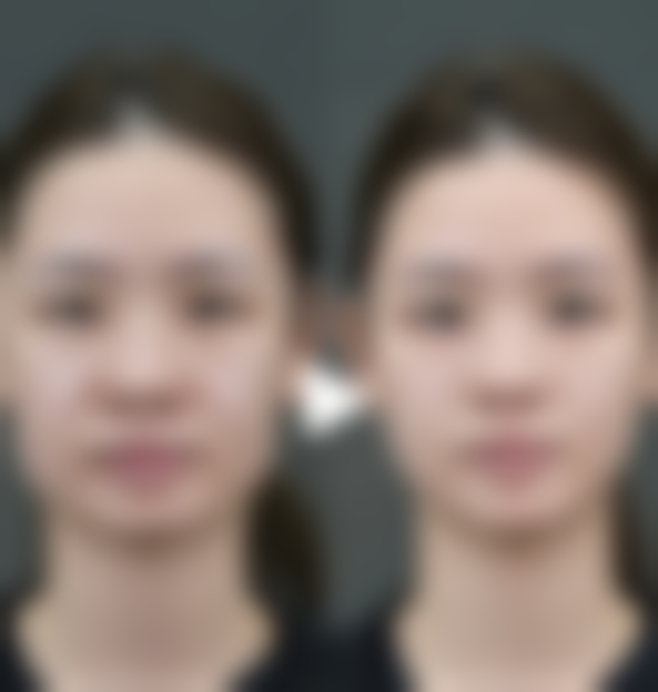 郴州青源医疗美容医院曹腾医生预约挂号指南