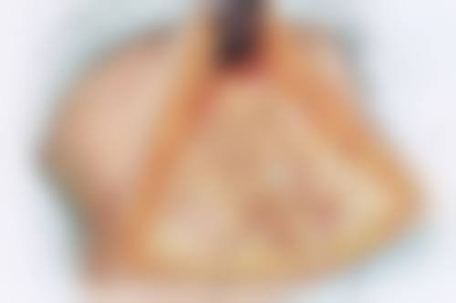 深圳微雕整形医院正规吗?