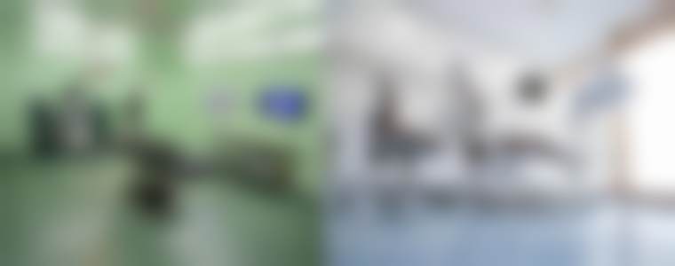 北京圣嘉新医疗美容医院在隆鼻失败后鼻部硅胶假体取出方面的实力如何？