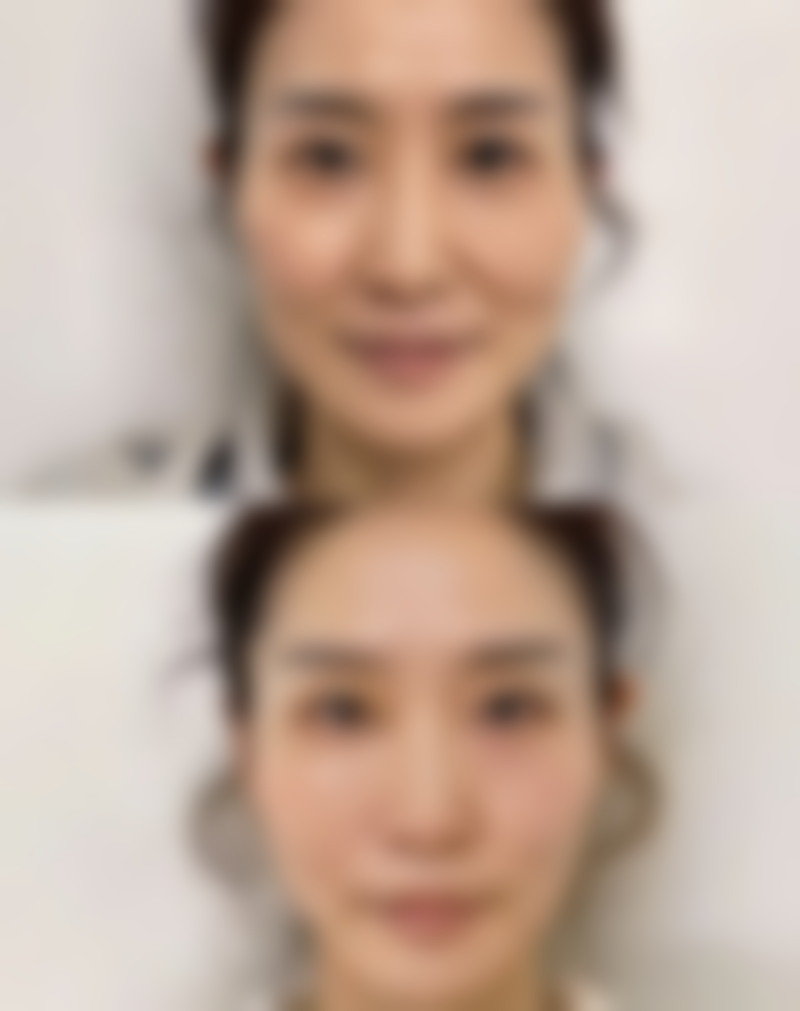 普洱(红十字)博爱医院整形美容科正规吗?