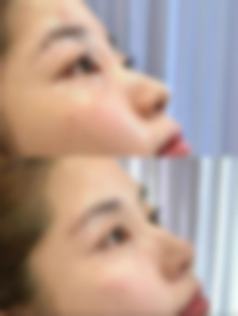 汕头大学医学校第一附属医院医学美容中 心怎么预约：