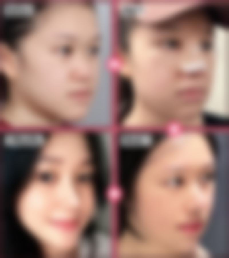 韩国SENSE整形外科口碑评价怎么样?