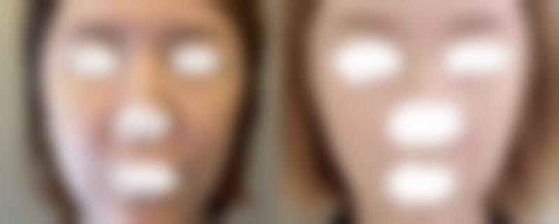 汕头大学医学校第一附属医院医学美容中 心收费价格表